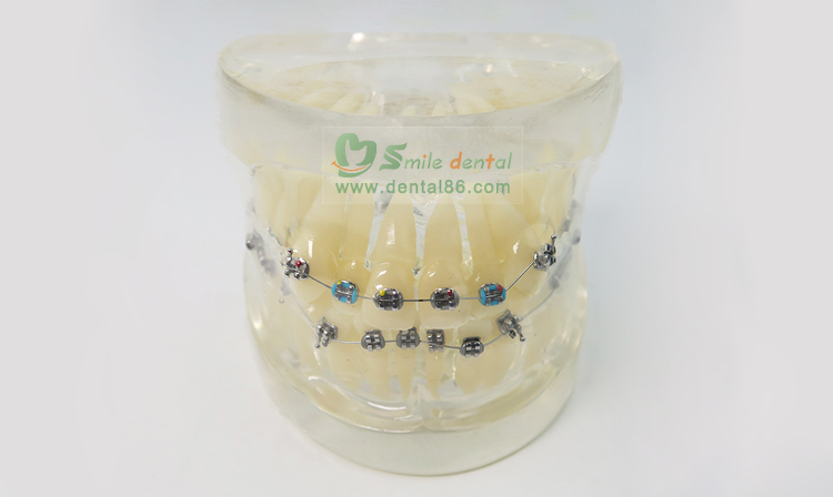 TM-B2-01 Orthodontic Model